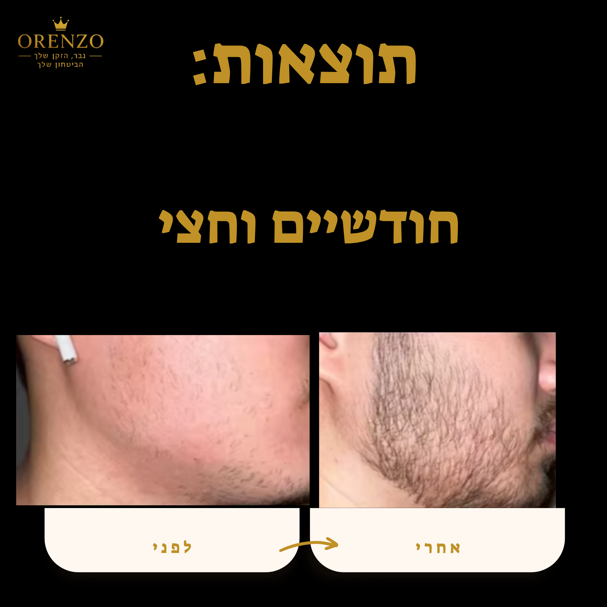 ערכת פרימיום - orenzo