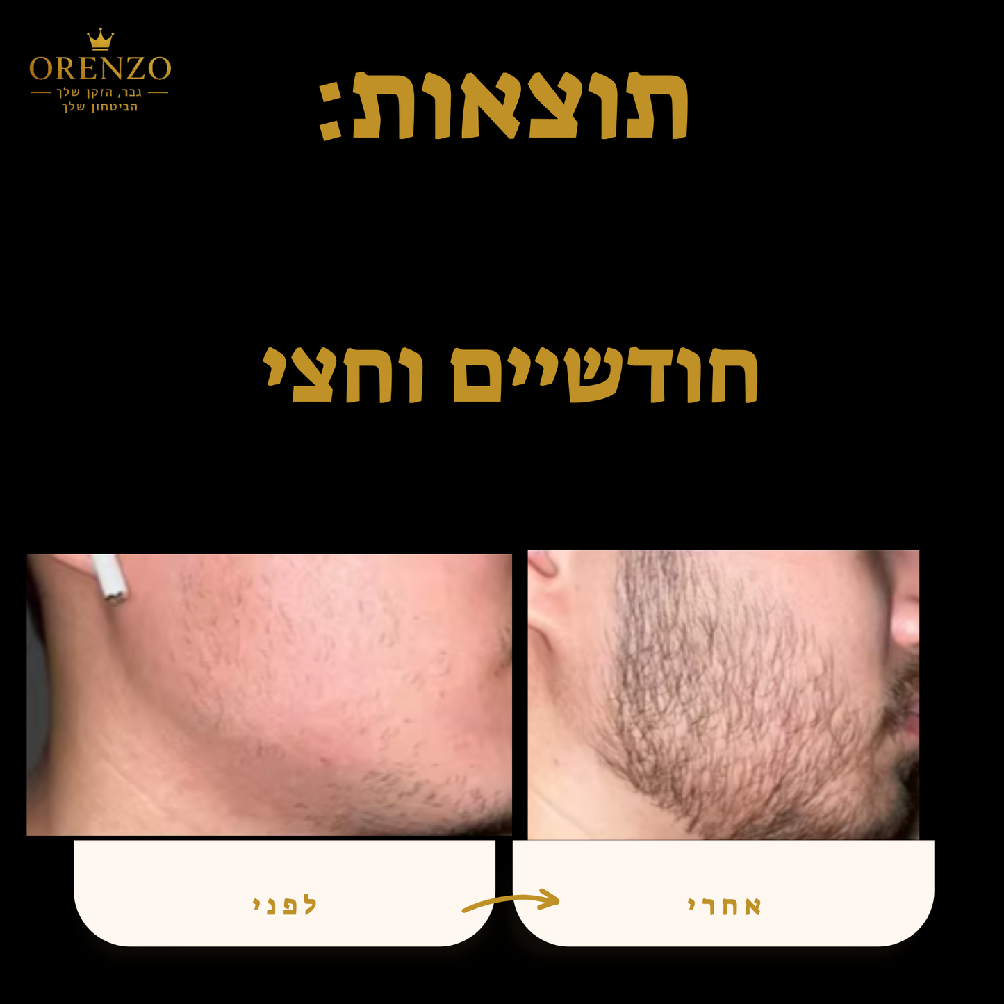 ערכת פרימיום - orenzo