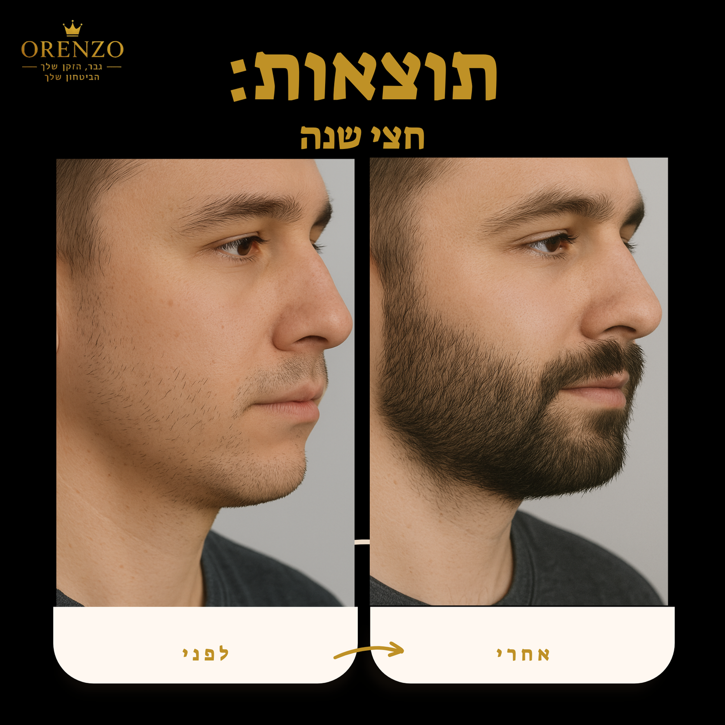 ערכת פרימיום - orenzo