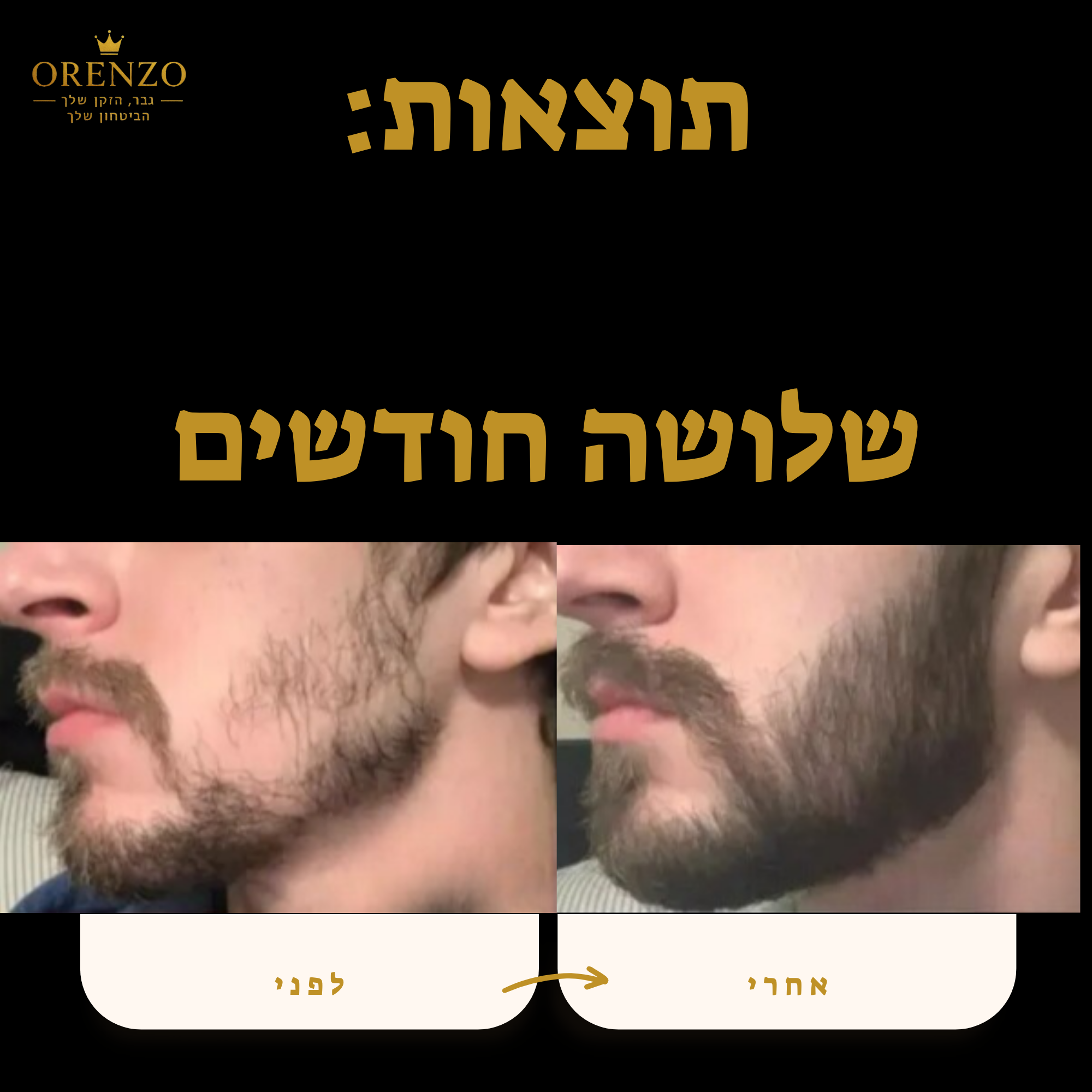 ערכת פרימיום - orenzo
